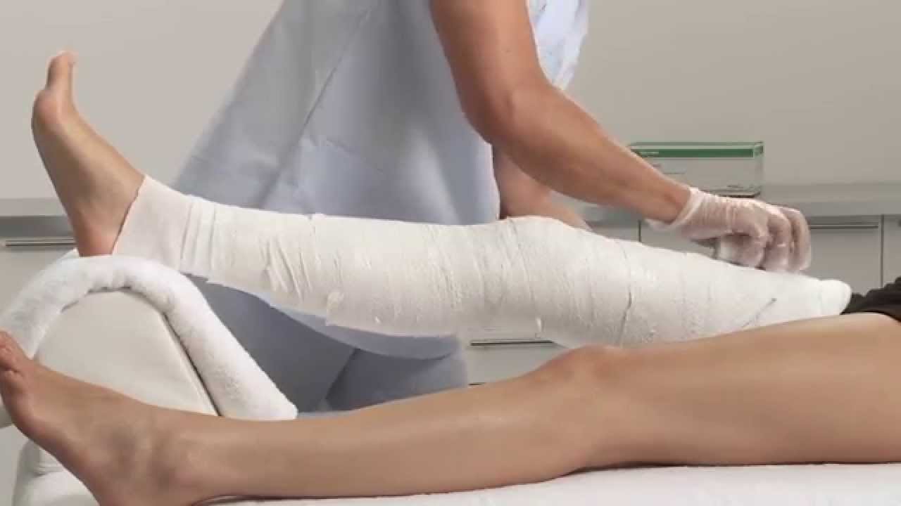 knee-circular-cast-pop-applicati